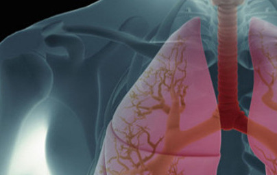 Бели дробове Бели дробове